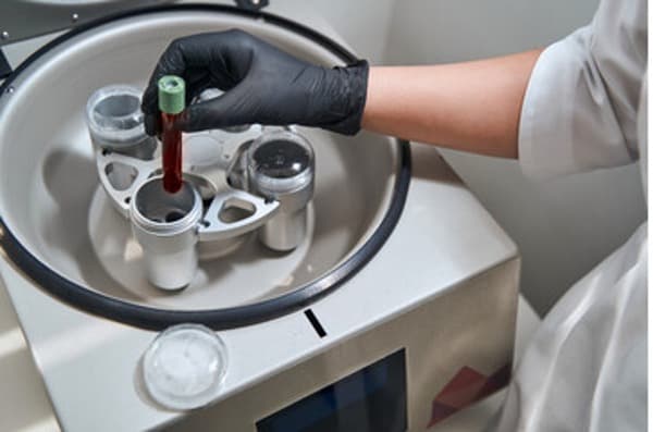 Image of a blood sample in a centrifuge machine.